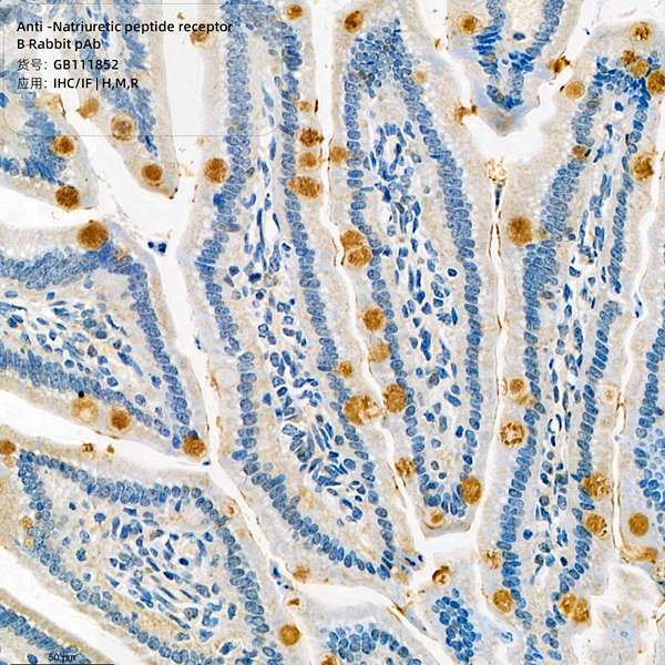 Антитела первичные, поликлональные, Natriuretic Peptide Receptor B, 100 мкл