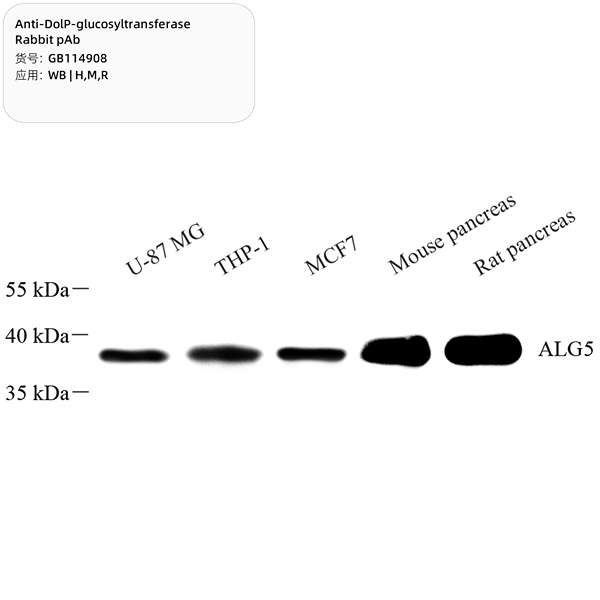 Антитела первичные, поликлональные, DolP-glucosyltransferase, 100 мкл