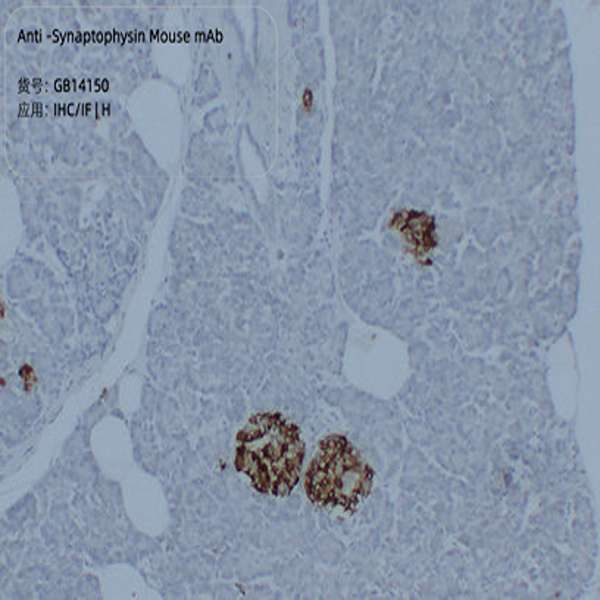Антитела первичные, моноклональные, Synaptophysin, 50 мкл