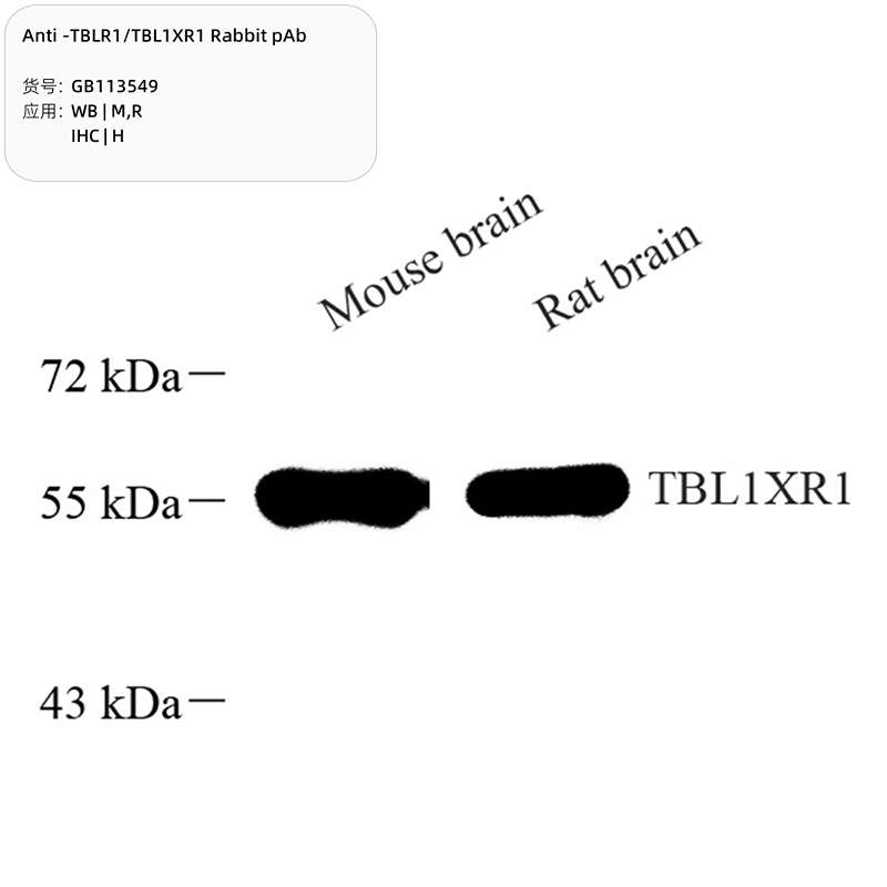 Антитела первичные, поликлональные, TBLR1/TBL1XR1, 100 мкл