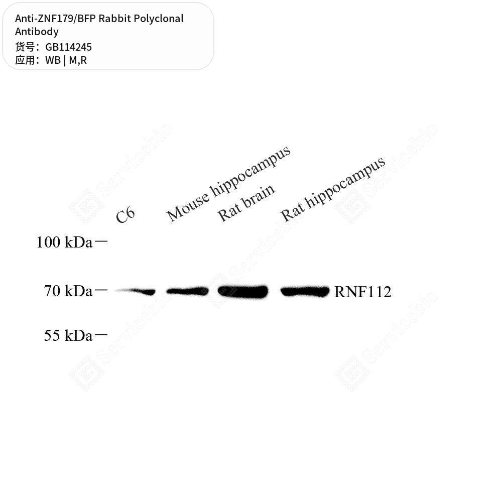 Антитела первичные, поликлональные кролика к ZNF179/BFP крысы, мыши, 100 мкл