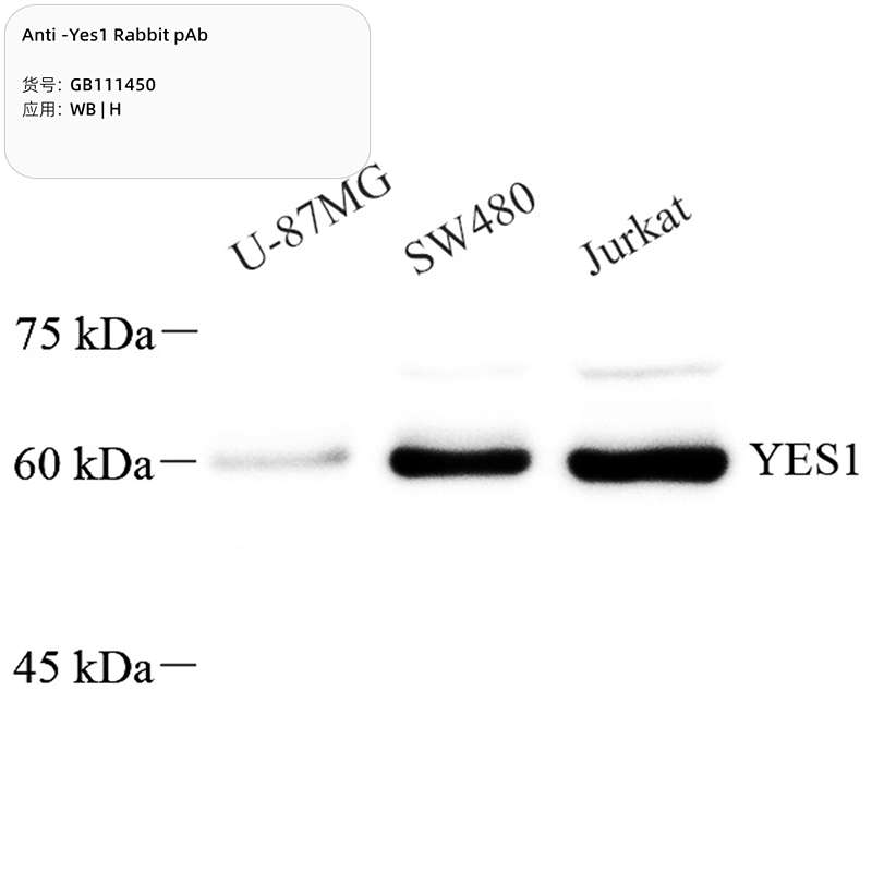 Антитела первичные, поликлональные, Yes1, 100 мкл