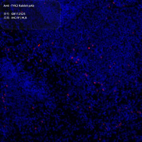 Антитела первичные, поликлональные, TYK2, 100 мкл