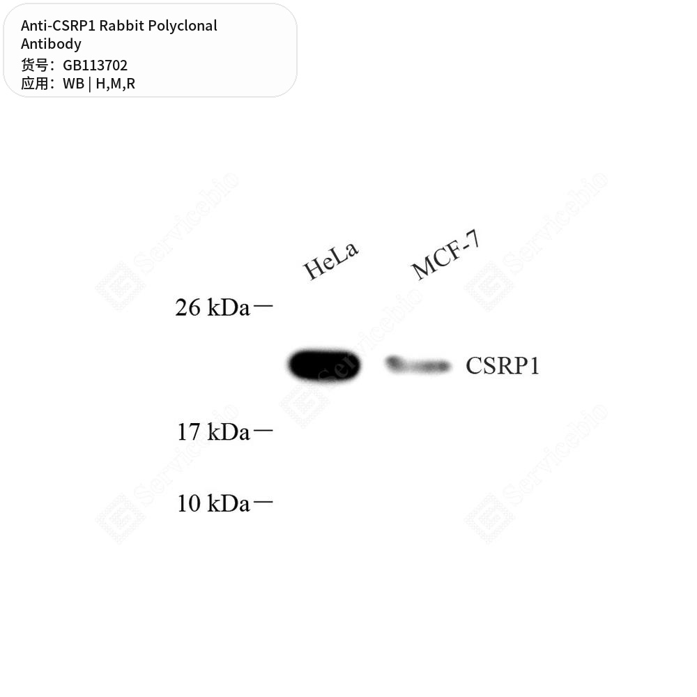 Антитела первичные, поликлональные кролика к CSRP1 крысы, мыши, человека, 100 мкл