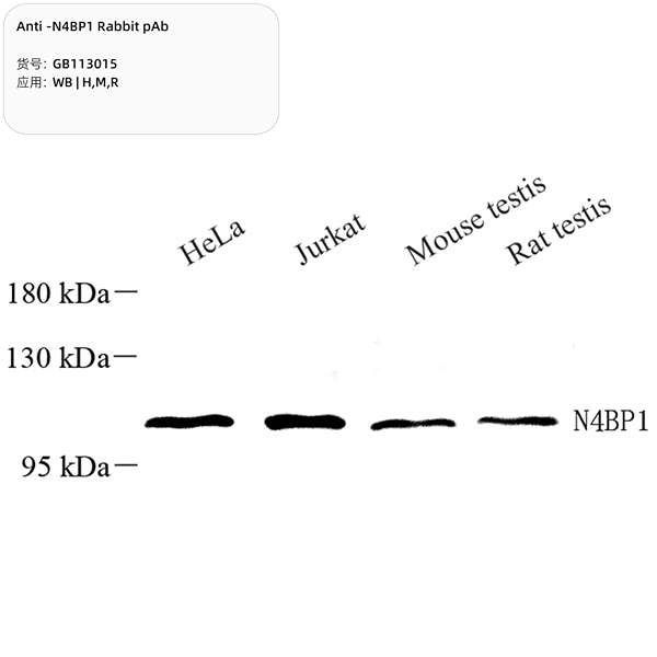 Антитела первичные, поликлональные, N4BP1, 100 мкл