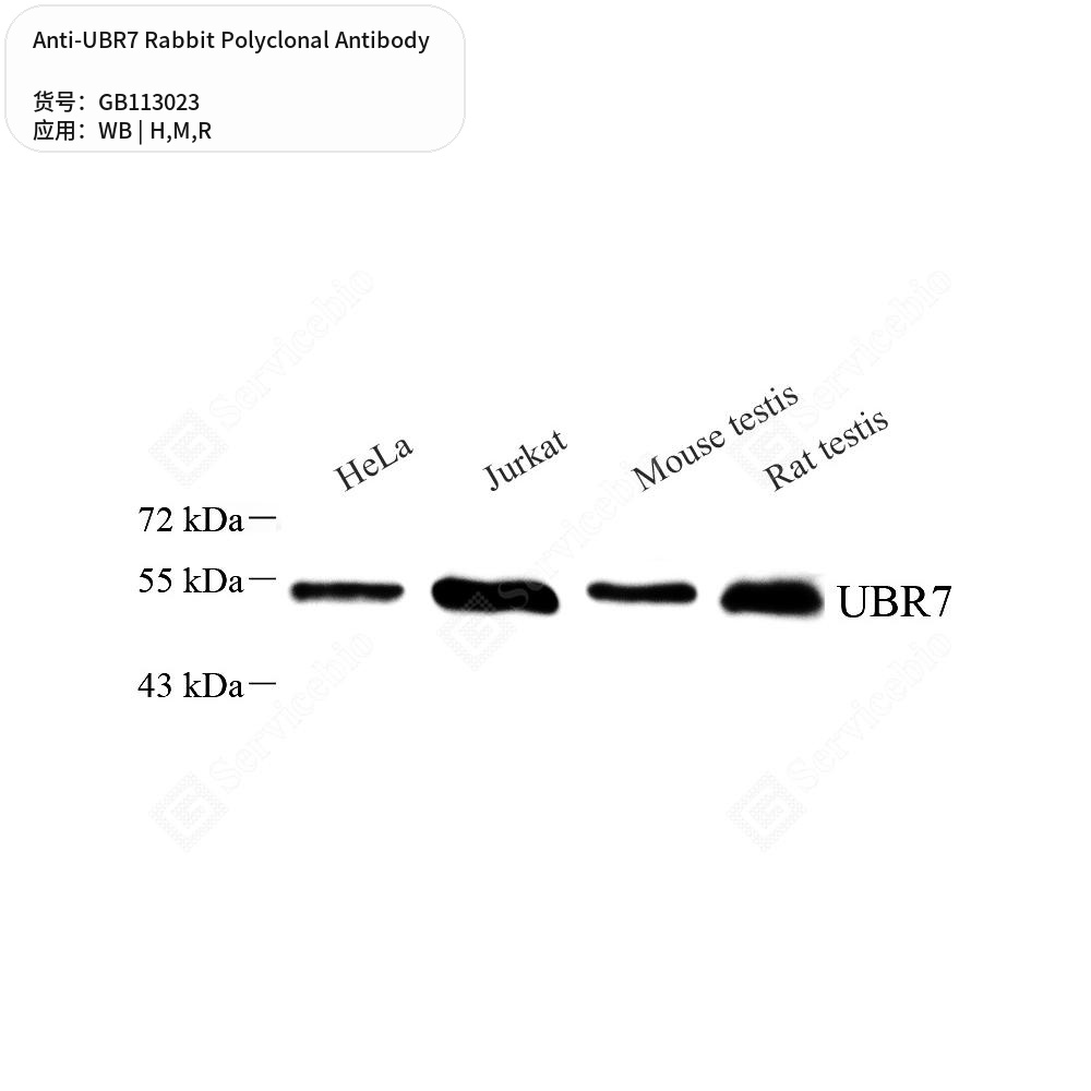 Антитела первичные, поликлональные кролика к UBR7 крысы, мыши, человека, 100 мкл