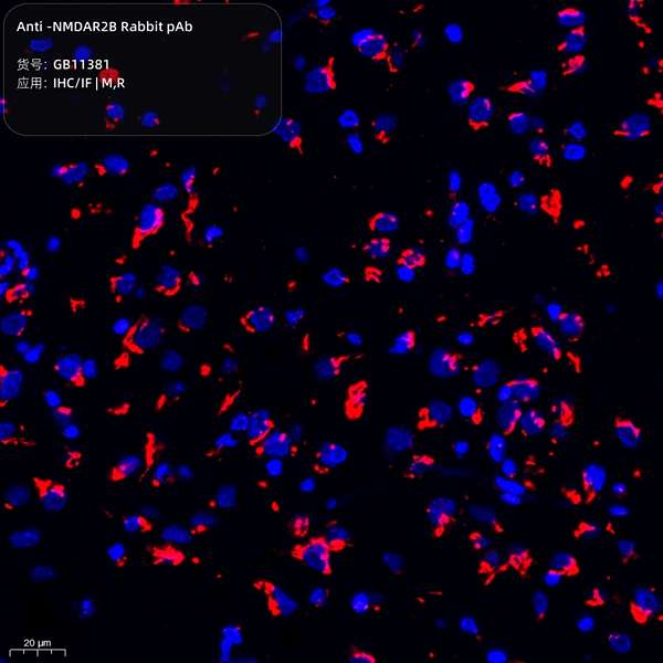 Антитела первичные, поликлональные, NMDAR2B, 100 мкл