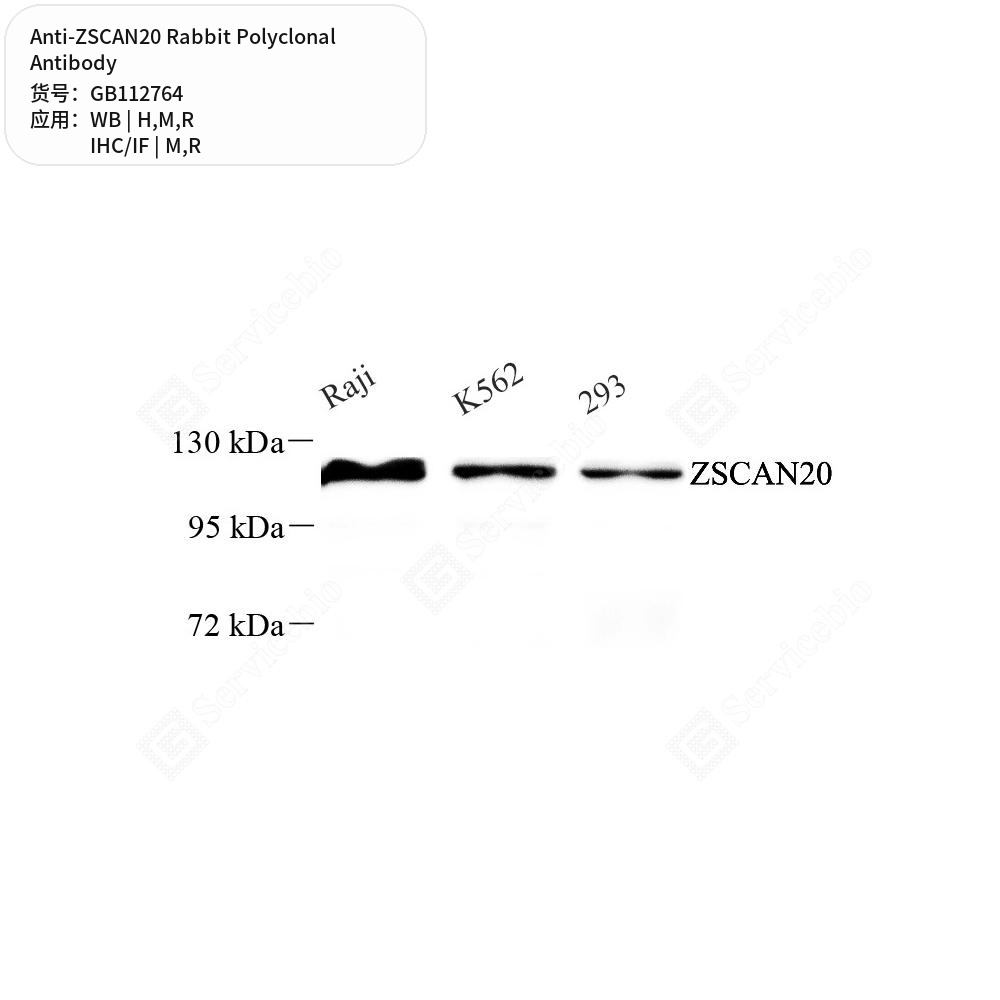 Антитела первичные, поликлональные кролика к ZSCAN20 крысы, мыши, человека, 50 мкл