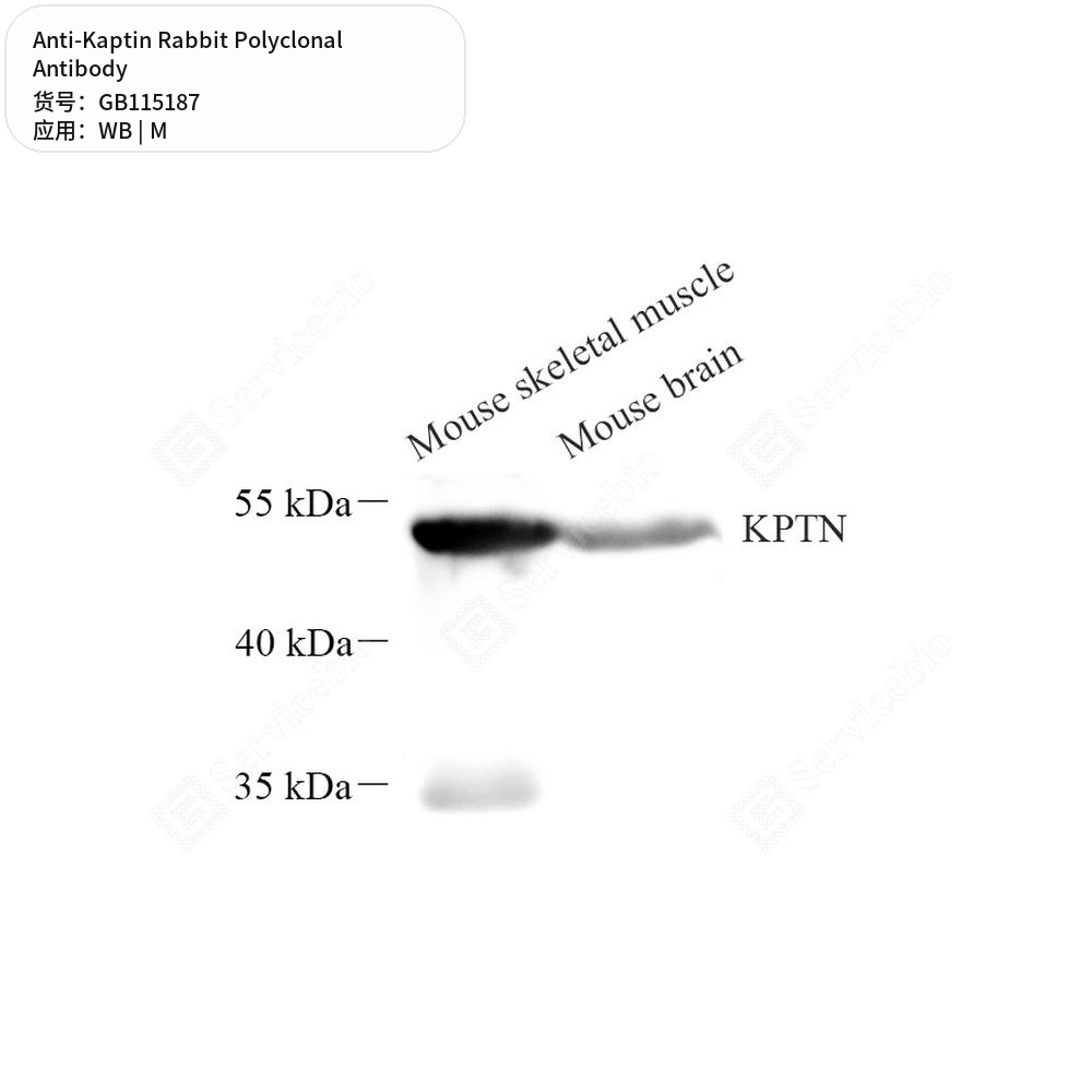 Антитела первичные, поликлональные кролика к Kaptin мыши, 50 мкл