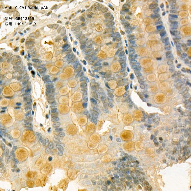 Антитела первичные, поликлональные, CLCA1, 100 мкл