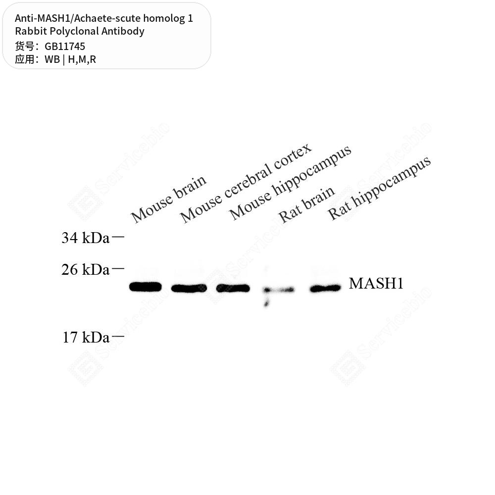 Антитела первичные, поликл. кролика к MASH1/Achaete-scute homolog 1 крысы, мыши, человека, 50 мкл