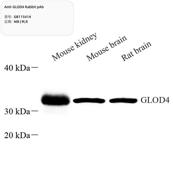 Антитела первичные, поликлональные, GLOD4, 100 мкл