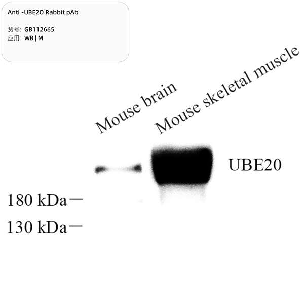 Антитела первичные, поликлональные, UBE2O, 100 мкл