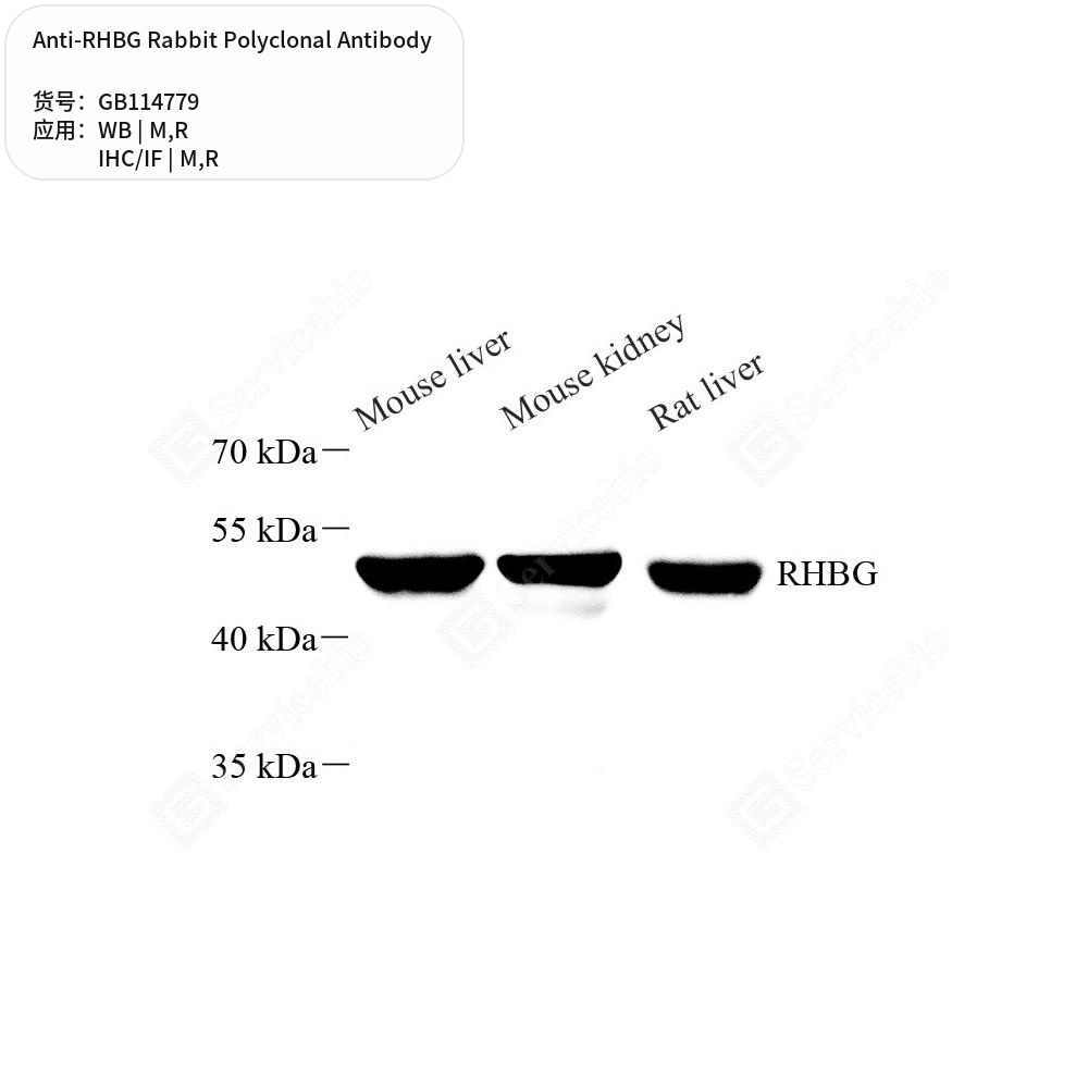 Антитела первичные, поликлональные кролика к RHBG крысы, мыши, 100 мкл