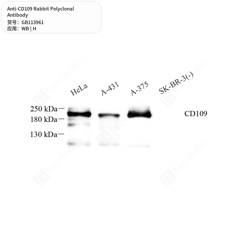 Антитела первичные, поликлональные кролика к CD109 человека, 100 мкл