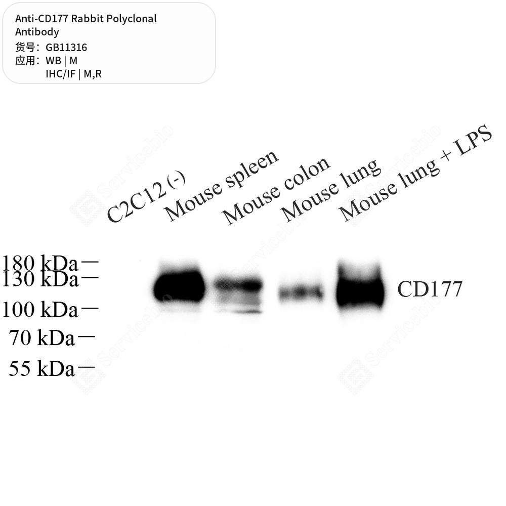 Антитела первичные, поликлональные кролика к CD177 крысы, мыши, 50 мкл