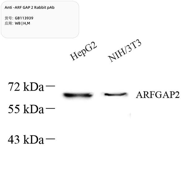 Антитела первичные, поликлональные, ARF GAP 2, 100 мкл