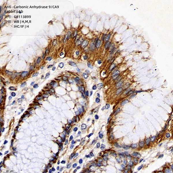 Антитела первичные, поликлональные, Carbonic Anhydrase 9/CA9, 100 мкл