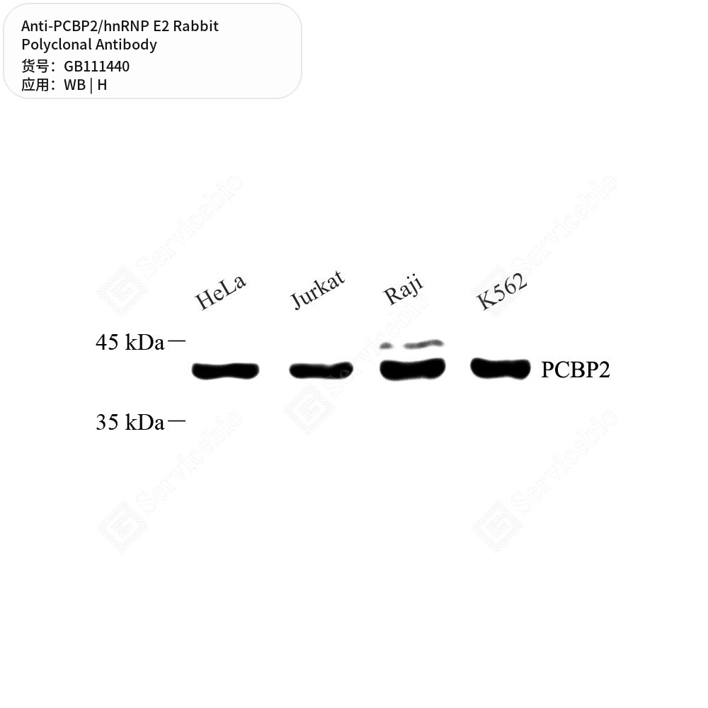 Антитела первичные, поликлональные кролика к PCBP2/hnRNP E2 человека, 100 мкл