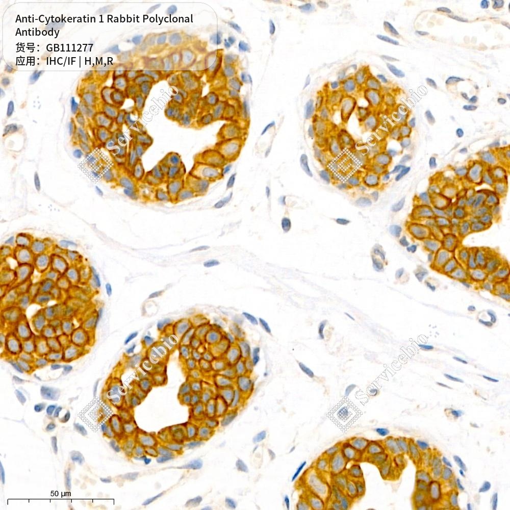 Антитела первичные, поликлональные кролика к Cytokeratin 1 крысы, мыши, человека, 100 мкл