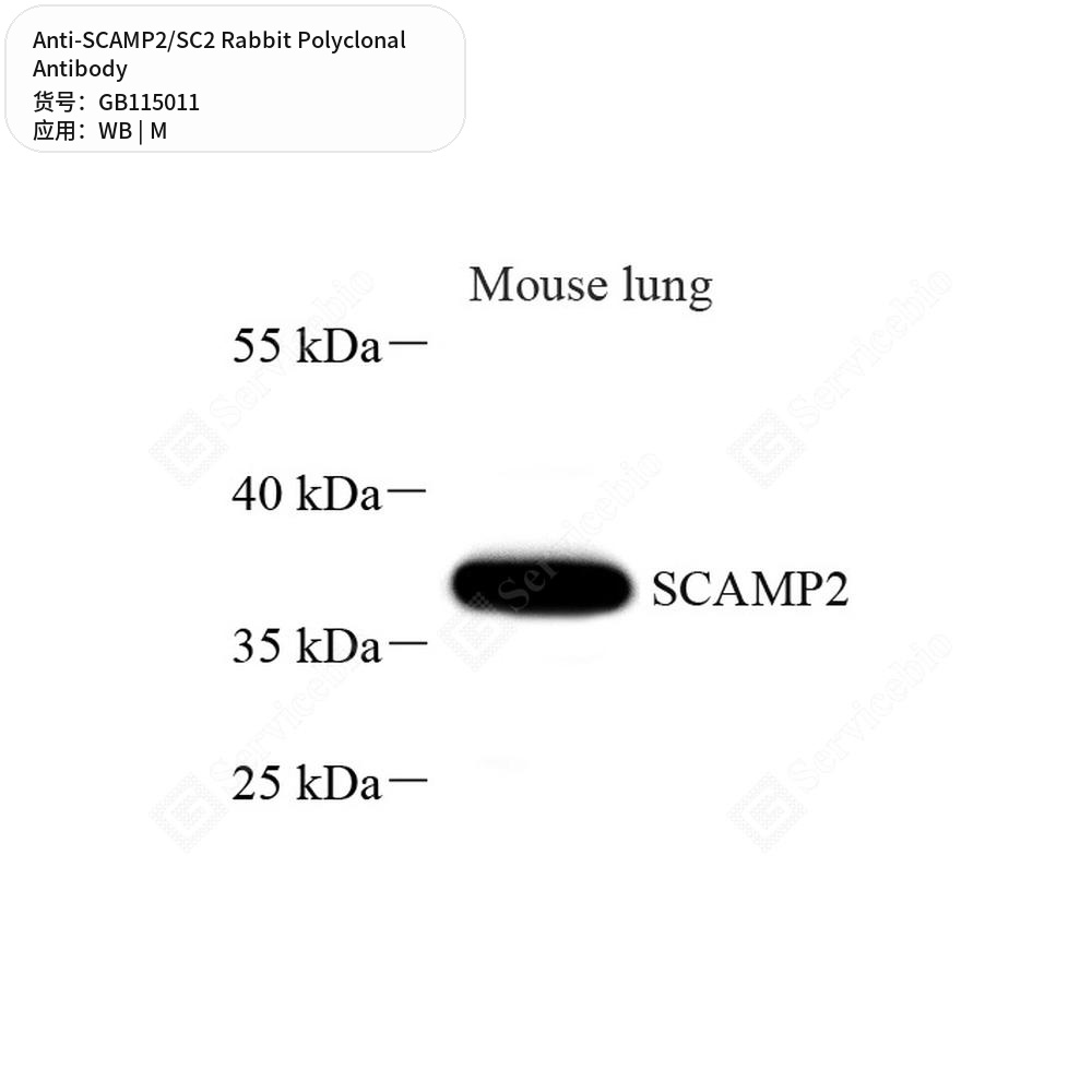 Антитела первичные, поликлональные кролика к SCAMP2/SC2 мыши, 50 мкл
