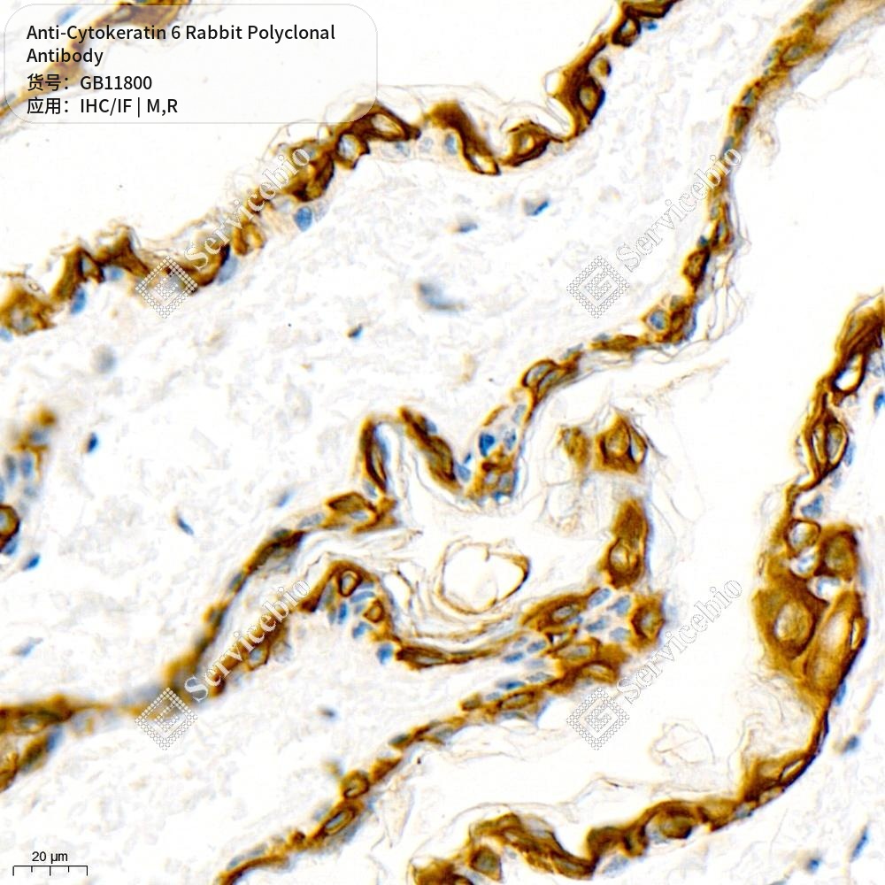 Антитела первичные, поликлональные кролика к Cytokeratin 6 крысы, мыши, 50 мкл