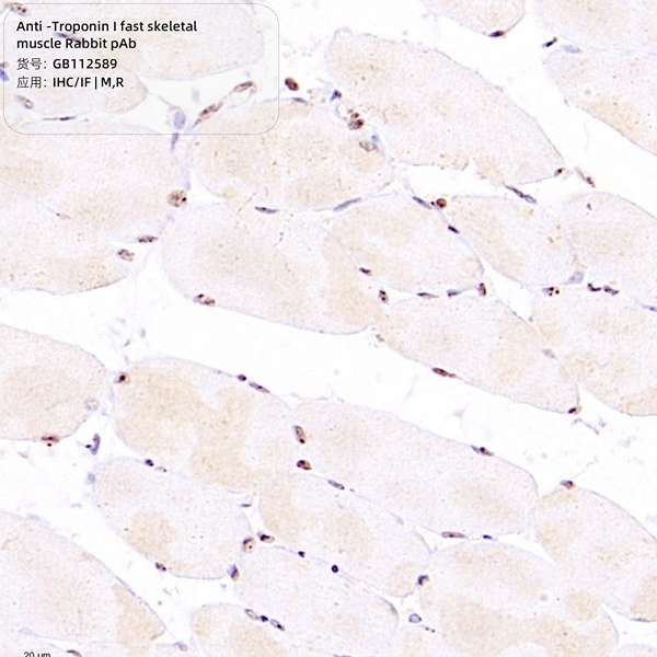 Антитела первичные, поликлональные, Troponin I fast skeletal muscle, 100 мкл