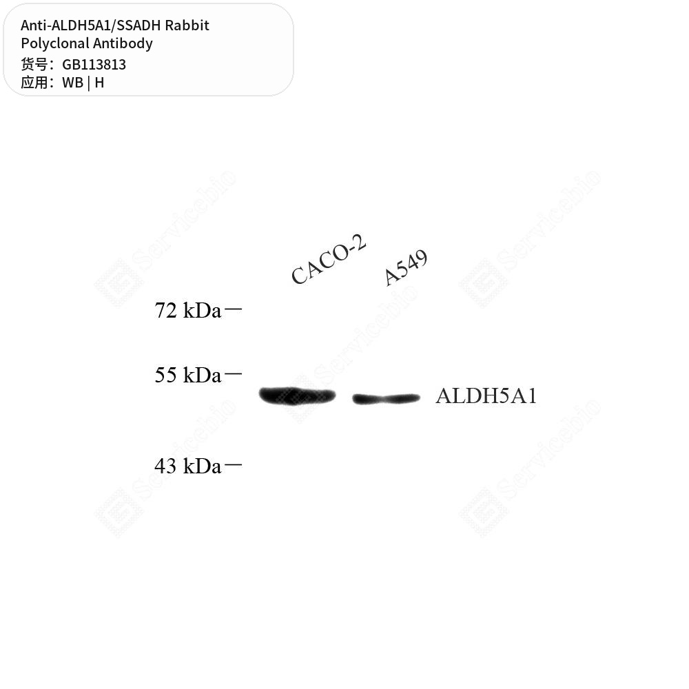 Антитела первичные, поликлональные кролика к ALDH5A1/SSADH человека, 100 мкл