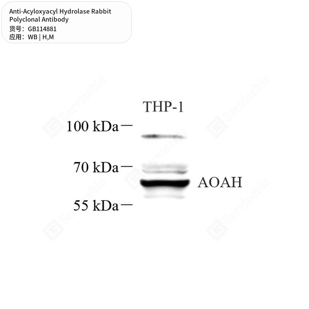 Антитела первичные, поликлональные кролика к Acyloxyacyl Hydrolase мыши, человека, 50 мкл