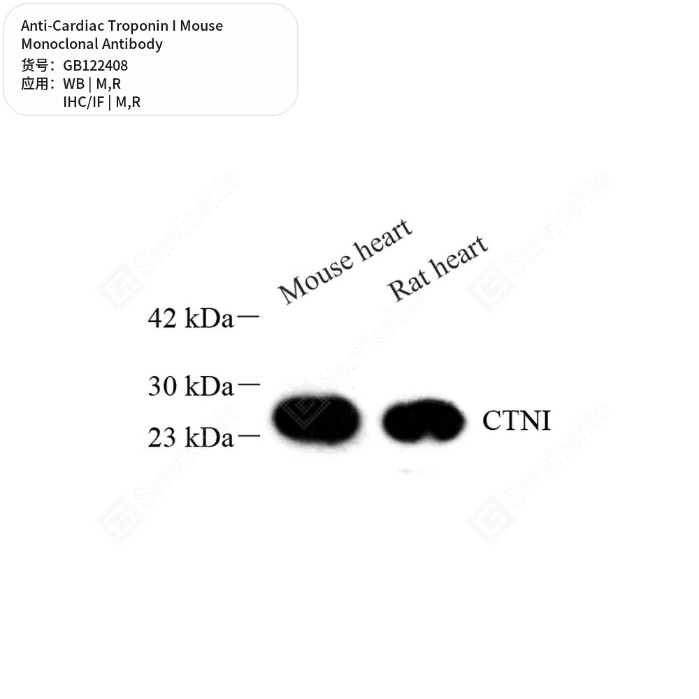 Антитела первичные, моноклональные мыши к Cardiac Troponin I крысы, мыши, 50 мкл