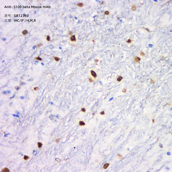 Антитела первичные, моноклональные, S100 beta, 100 мкл