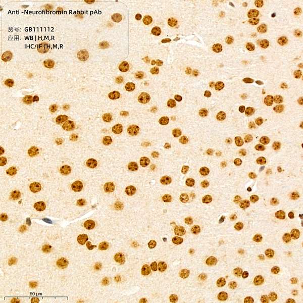Антитела первичные, поликлональные, Neurofibromin, 100 мкл