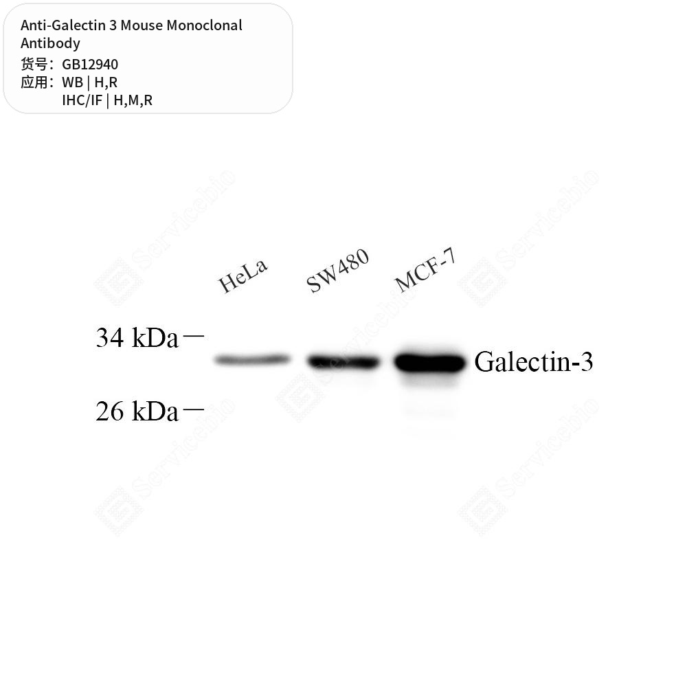 Антитела первичные, моноклональные мыши к Galectin 3 крысы, мыши, человека, 50 мкл