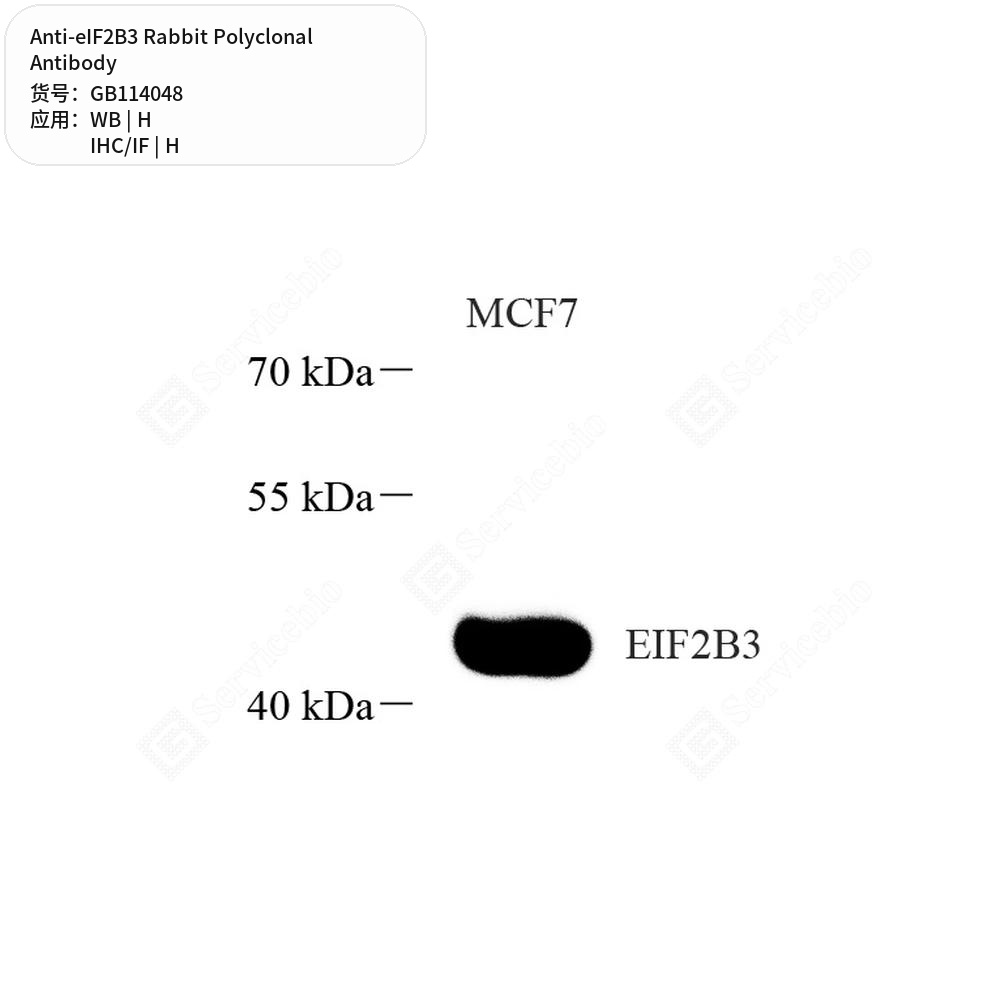 Антитела первичные, поликлональные кролика к eIF2B3 человека, 50 мкл