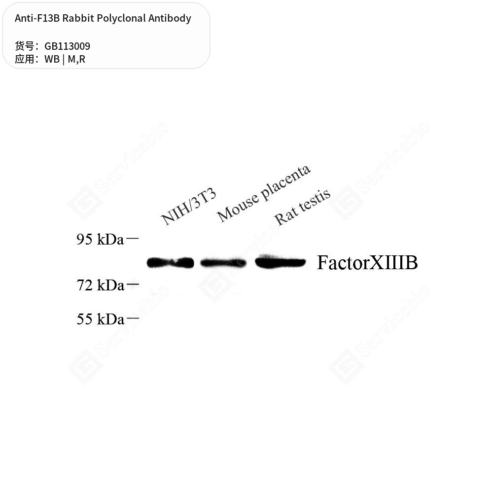 Антитела первичные, поликлональные кролика к F13B крысы, мыши, 50 мкл