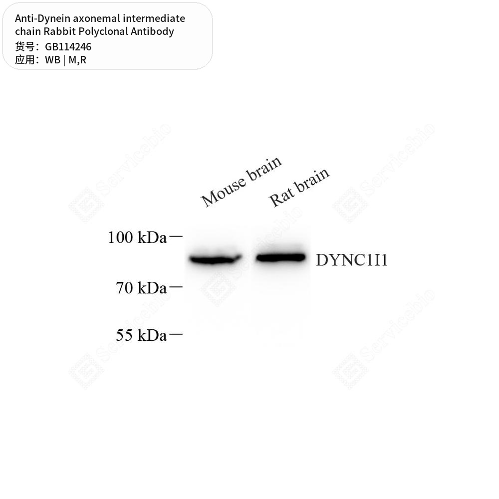 Антитела первичные, поликл. кролика к Dynein axonemal intermediate chain крысы, мыши, 100 мкл