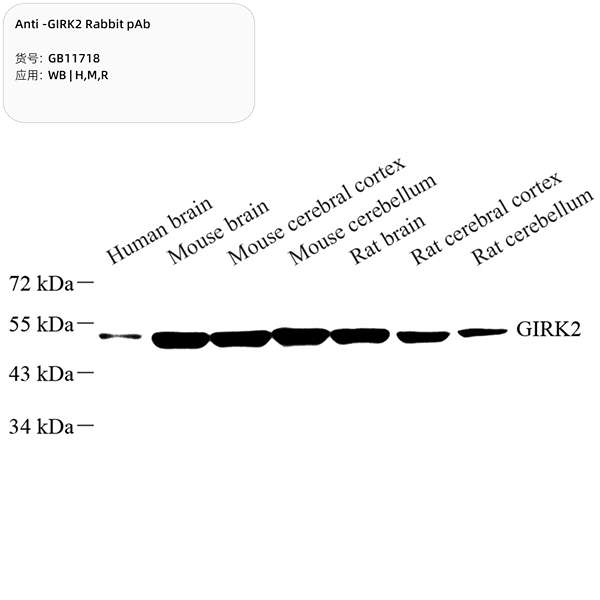 Антитела первичные, поликлональные, GIRK2, 100 мкл