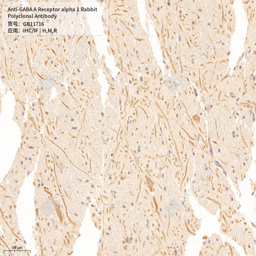 Антитела первичные, поликлональные кролика к GABA A Receptor alpha 1 крысы, мыши, человека, 100 мкл
