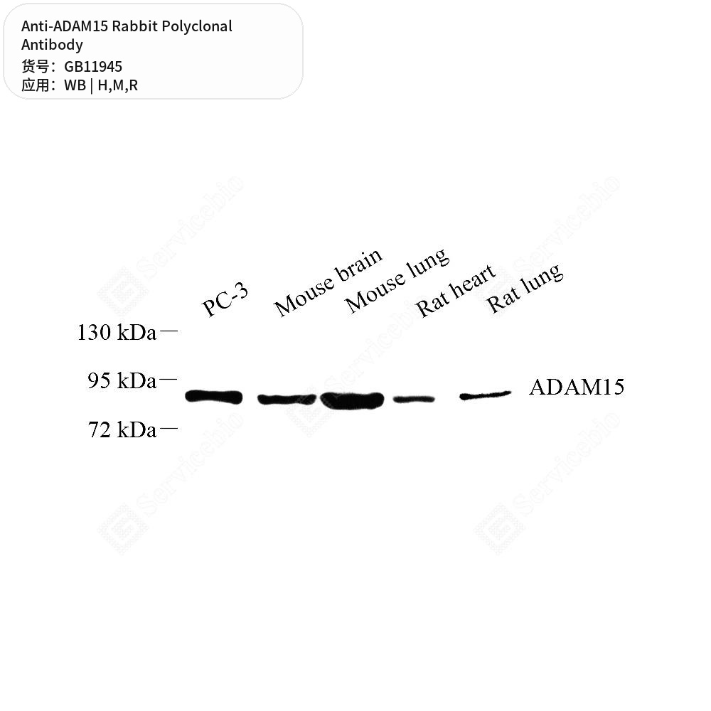 Антитела первичные, поликлональные кролика к ADAM15 крысы, мыши, человека, 50 мкл