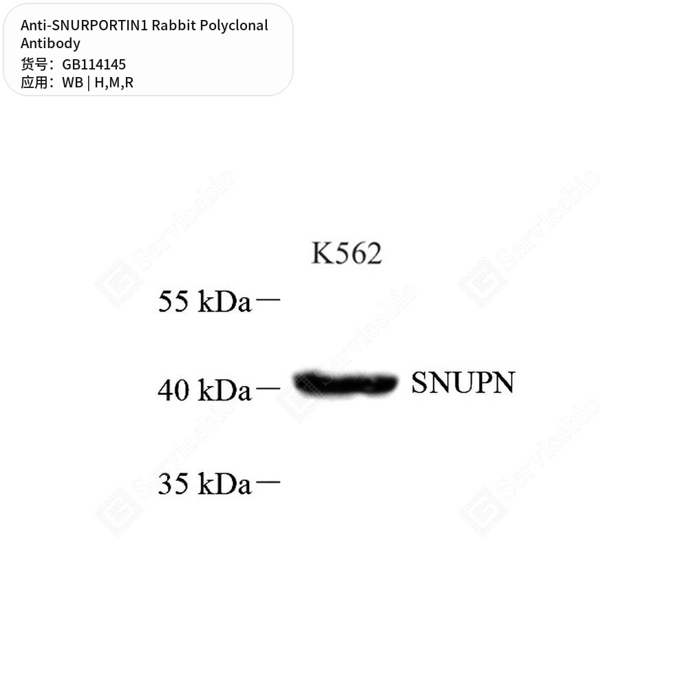 Антитела первичные, поликлональные кролика к SNURPORTIN1 крысы, мыши, человека, 100 мкл