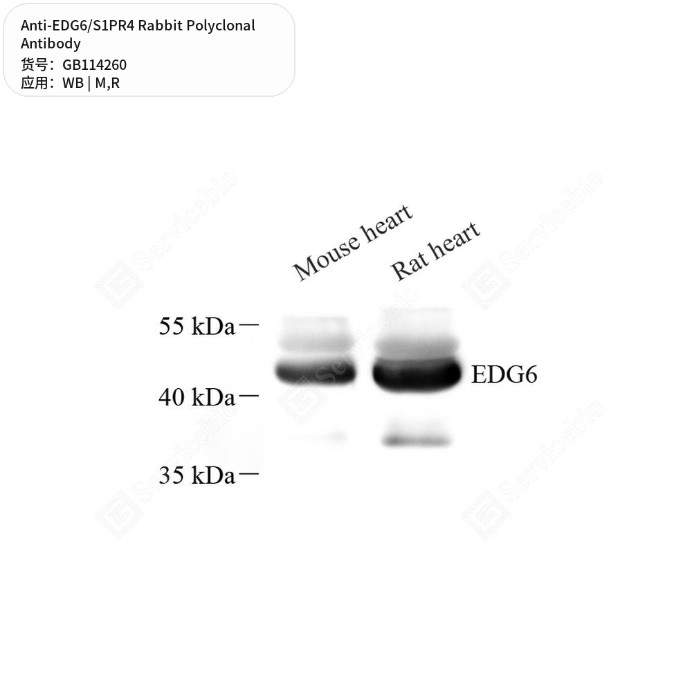 Антитела первичные, поликлональные кролика к EDG6/S1PR4 крысы, мыши, 100 мкл