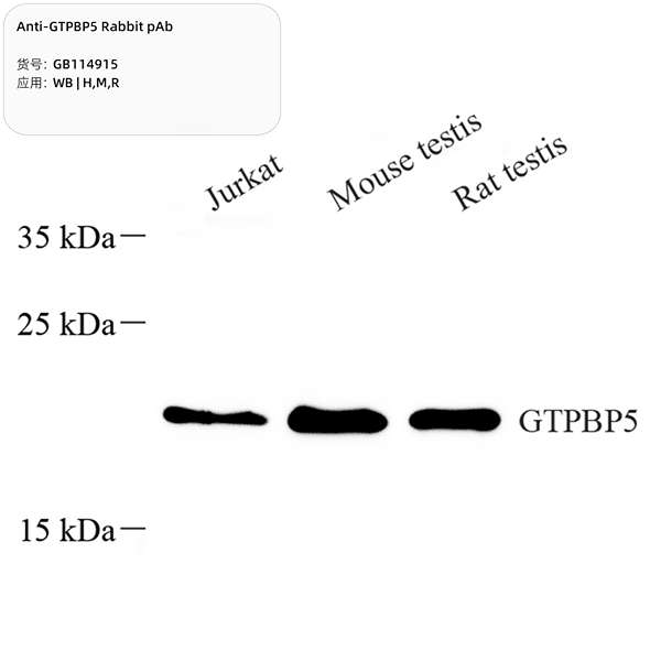 Антитела первичные, поликлональные, GTPBP5, 100 мкл
