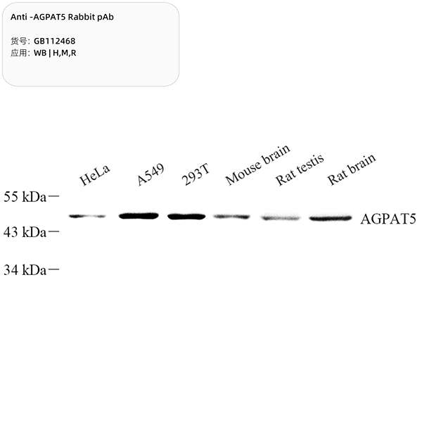 Антитела первичные, поликлональные, AGPAT5, 100 мкл