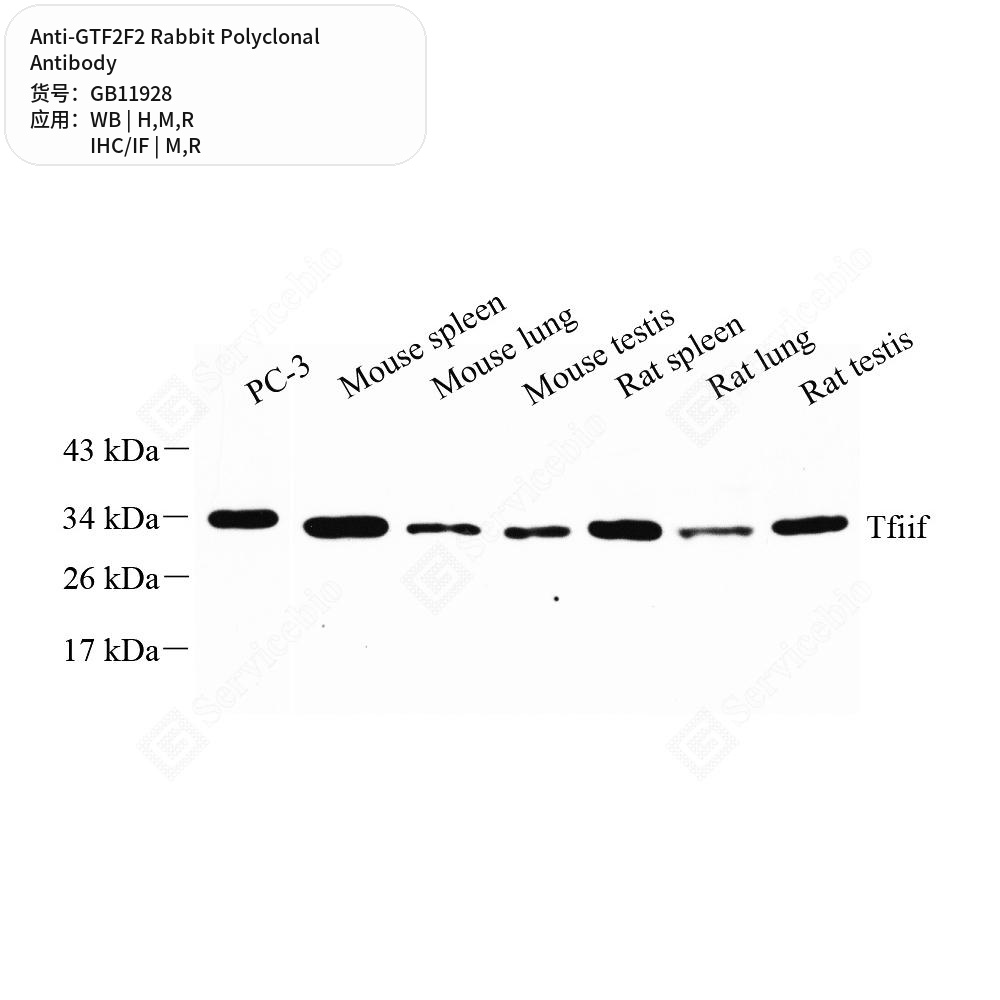 Антитела первичные, поликлональные кролика к GTF2F2 крысы, мыши, человека, 50 мкл
