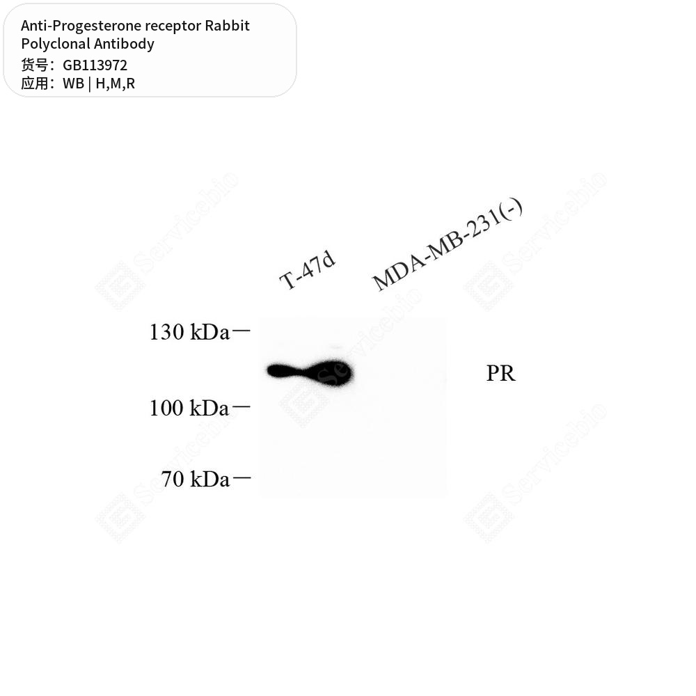 Антитела первичные, поликлональные кролика к Progesterone receptor крысы, мыши, человека, 50 мкл