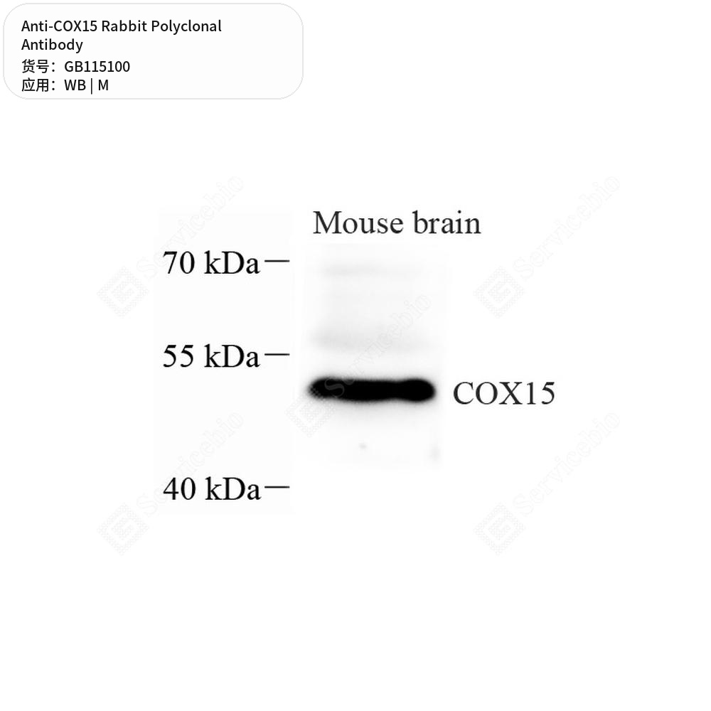 Антитела первичные, поликлональные кролика к COX15 мыши, 50 мкл