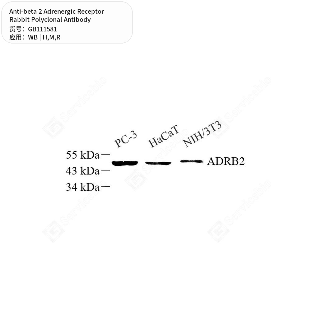 Антитела первичные, поликл. кролика к beta 2 Adrenergic Receptor крысы, мыши, человека, 100 мкл