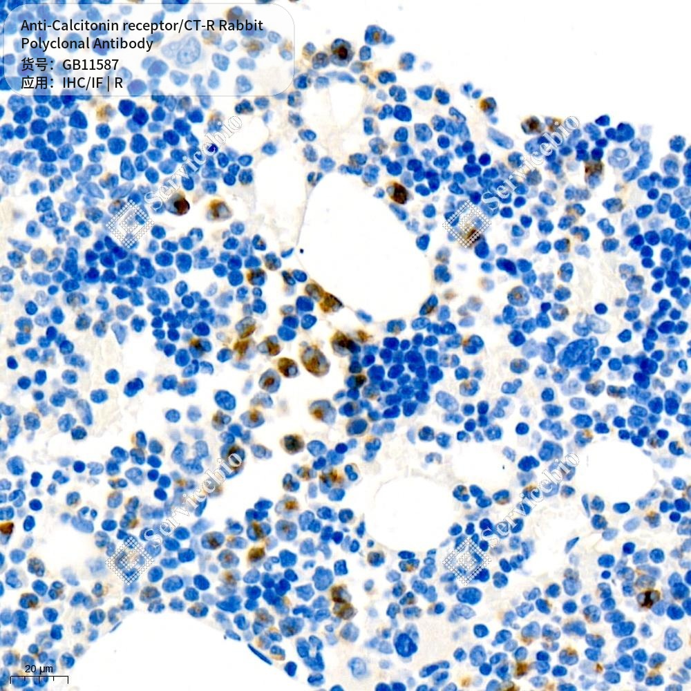 Антитела первичные, поликлональные кролика к Calcitonin receptor/CT-R крысы, 50 мкл
