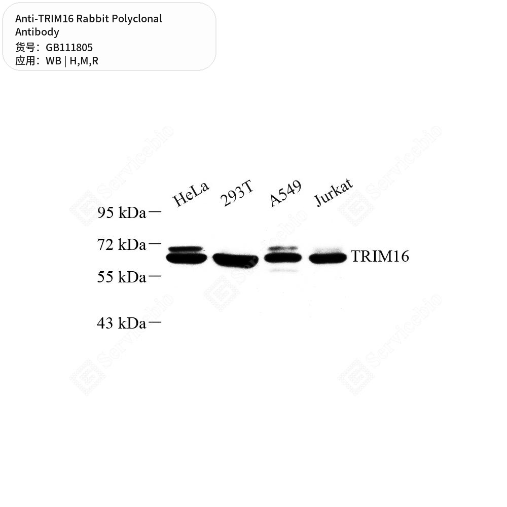 Антитела первичные, поликлональные кролика к TRIM16 крысы, мыши, человека, 100 мкл