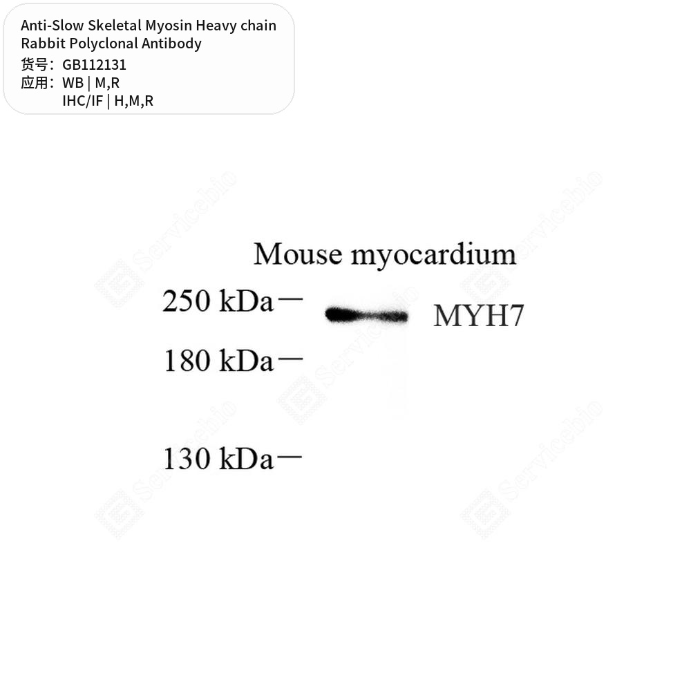 Антитела первичные, поликл. кролика к Slow Skeletal Myosin Heavy chain крысы, мыши, чел., 100 мкл